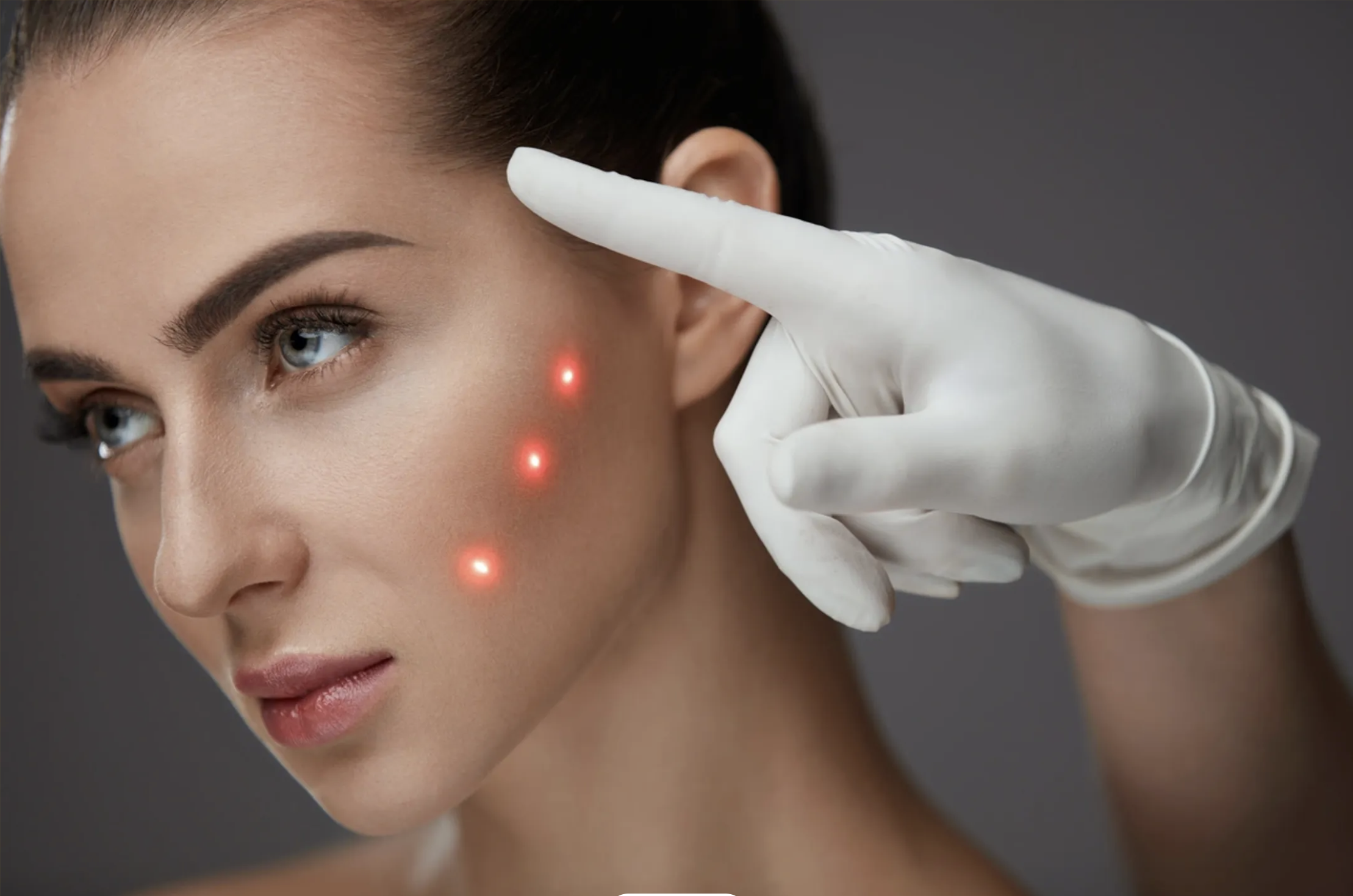 Dr. Yasmin Harounian L.Ac performing needle-less laser acupuncture treatment in her Los Angeles clinic